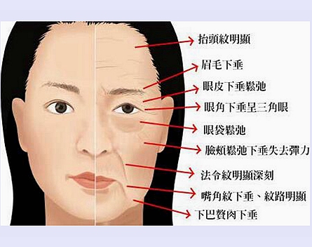 女人一到到中年,各种肌肤问题就出现了,特别是面部消息温和眼角的皱纹