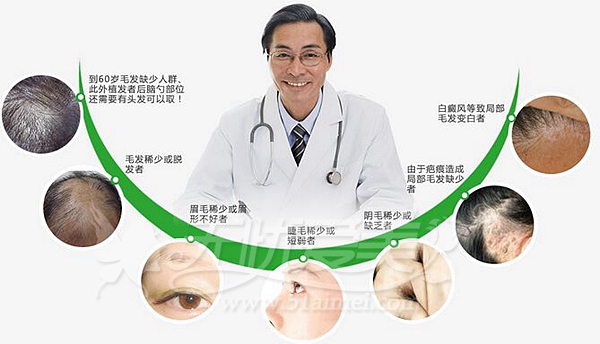 LHS高端植发技术-杭州杭城皮肤病医院-无忧爱