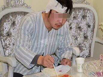 26岁小伙脱发3年,在北京博士园5小时植发手术