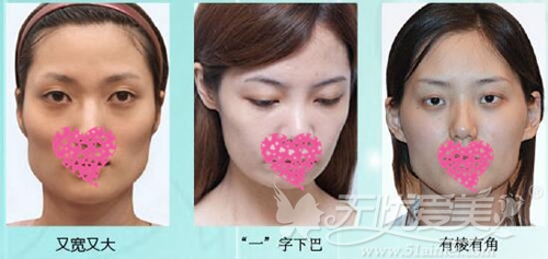 重庆西南脸部磨骨术价格是多少?哪位医生做的好?