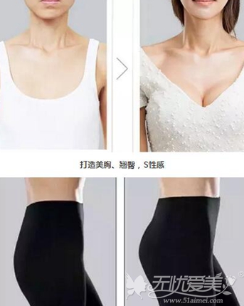 南京自体脂肪丰胸手术多少钱?施尔美整形丰胸技术好吗?