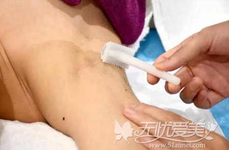 中信惠州医院能做激光脱毛吗?有案例吗?价格是多少?
