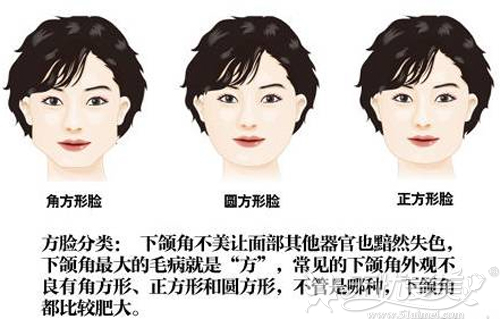 想知道改脸型多少钱就来看广州中家医这份颌面整形价格表