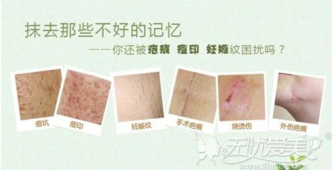 上海虹桥医院有激光祛疤吗?激光祛烫伤疤痕效果如何价格呢?