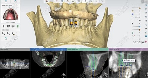 福州福能海峡口腔治疗仪器