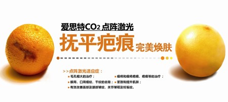 岳阳爱思特CO2点阵激光 抚平皱纹完美焕肤