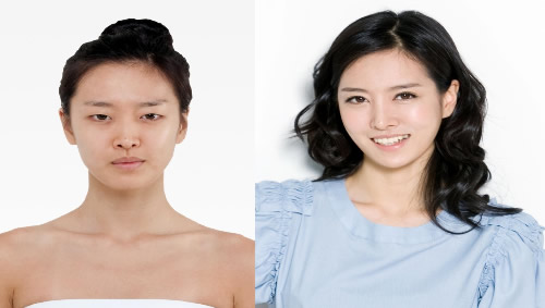韩国整形外科繁忙寒假期 双眼皮和隆鼻整形较火热