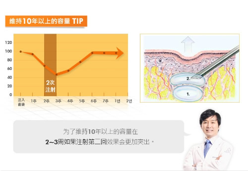 注射爱贝芙究竟怎么样呢