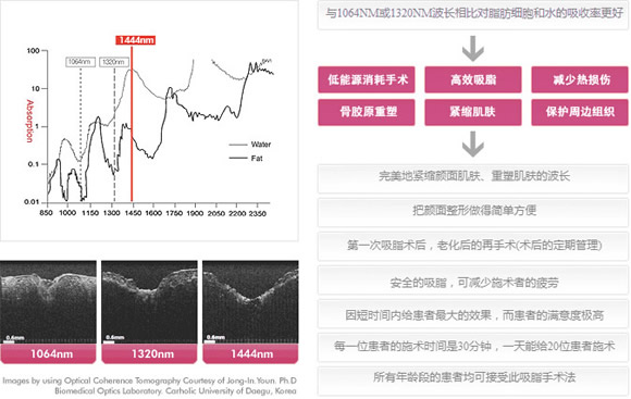 AccuSculpt激光除皱整形