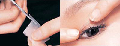 双眼皮贴VS韩式双眼皮手术 哪个美得更放心?