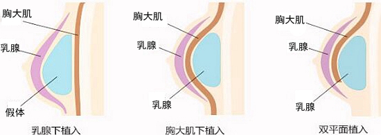 魔力沟丰胸