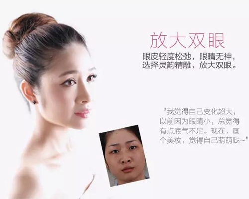 爱思特单眼皮脱单季——灵韵精雕大眼术(特价)