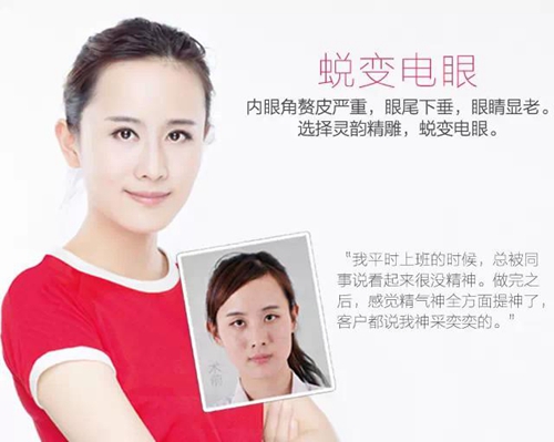 爱思特单眼皮脱单季——灵韵精雕大眼术(特价)
