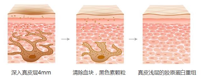 SR美白嫩肤