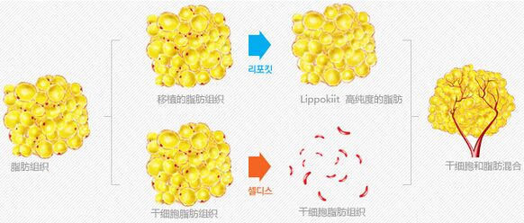 韩国艺德雅整形