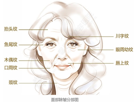 南充新韵悦美 定格青春注射除皱