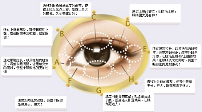 福州海峡双眼皮手术优势