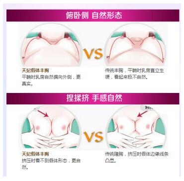 重庆时光隆胸医生揭秘自体脂肪隆胸和假体隆胸的差异