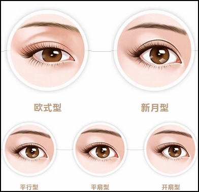 成都天之美双眼皮手术医生刘宁解答常见双眼皮问题