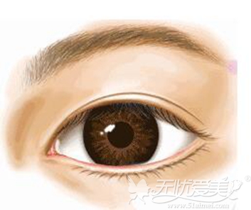 广州粤秀双眼皮手术特点：让您的眼睛亮起来