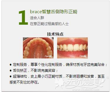 盐城艾美莉牙齿正畸