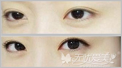 郑州欧兰纹眼线
