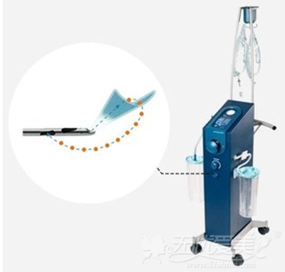 自贡西婵德国水分子刀微吸脂仪