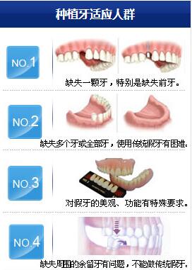 郑州植地3D微创种植牙适合人群