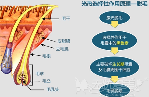 赣州俪人无痛冰点脱毛