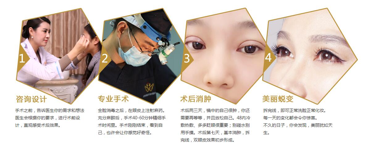 北京彤美双眼皮修复流程