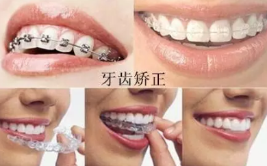 韩国优露牙科的牙齿矫正器