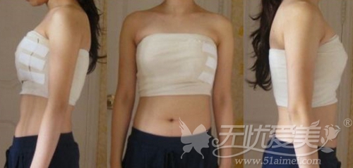 金秀妍在韩国麦恩整形外科假体隆胸手术后2天