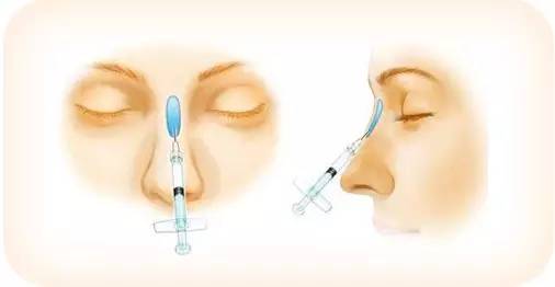 北京美莱隆鼻特色项目:玻尿酸隆鼻