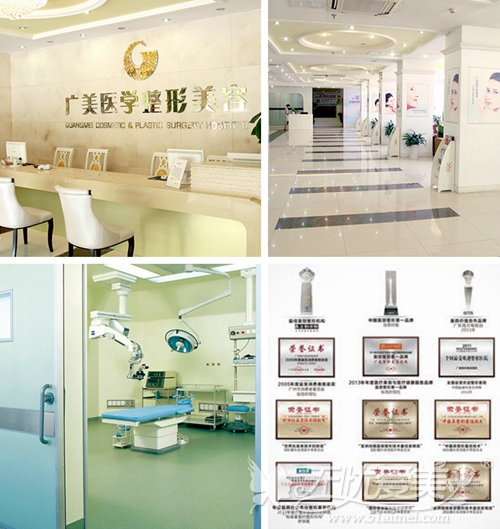 广州广美整形医院正规吗 做双眼皮手术怎么样？