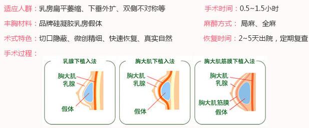 重庆军美V型假体丰胸手术过程