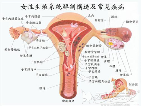女性生殖系统常见疾病