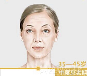 35-45中度衰老