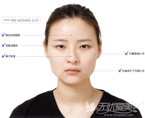 郑心妍在韩国TL整形医院设计的手术方案