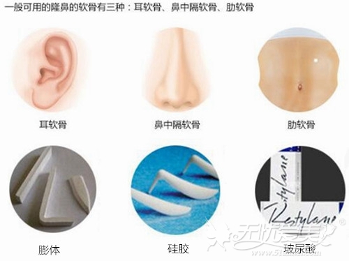 北京丽都鼻综合手术中常用的隆鼻材料