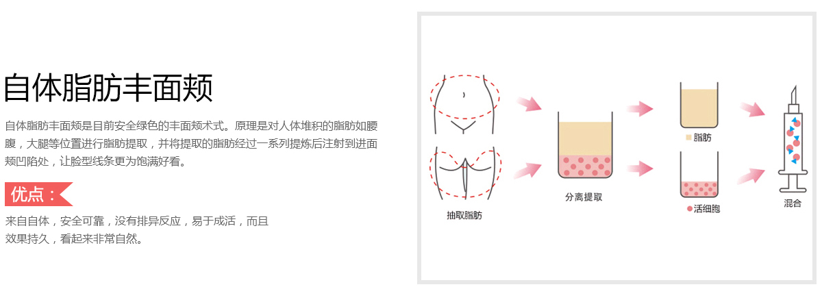 珠海仁爱医院自体脂肪丰面颊