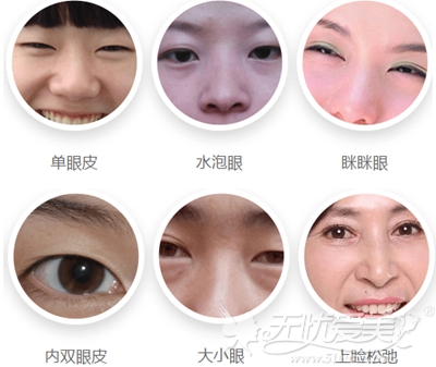 安徽韩美韩式双眼皮手术可改善的眼部问题