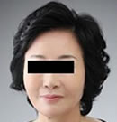 北京玉之光宋丽秋院长,用3D液态拉皮让我面部重回年轻态!