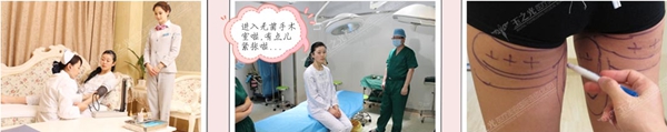 瑶瑶在北京玉之光做自体脂肪丰胸术前检查到设计