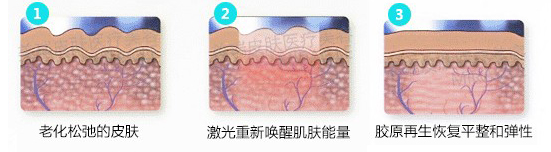 大同逆时光面部除皱术