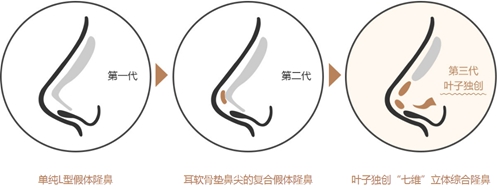 北京叶子鼻综合使用的假体