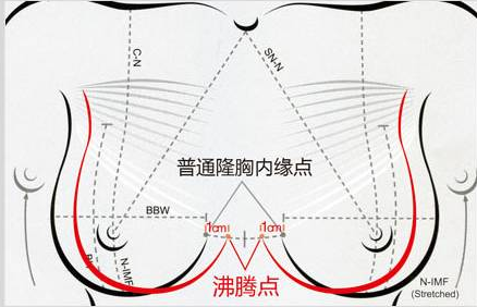 福州海峡沸腾沟丰胸 让你美胸无痕