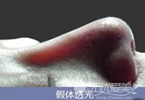 沈阳百嘉丽10月14号推出首款“全隐身”超体Transplus鼻假体