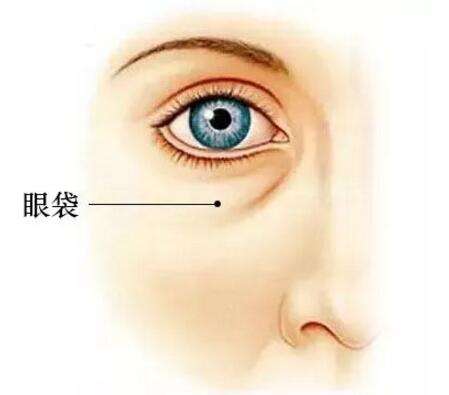 广州澳玛星光医疗美容祛眼袋