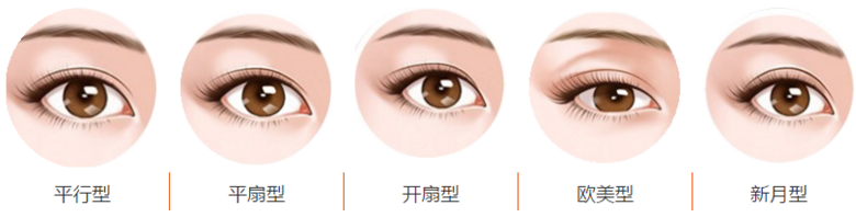 武汉米兰韩式双眼皮手术类型