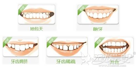 各种需要进行牙齿矫正的牙型